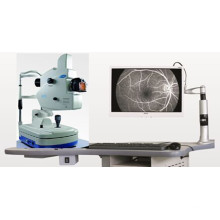 Fundus Camera & Ffa /Retina Camera& Ffa